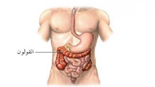 أفضل أدوية في الصيدلية لعلاج القولون