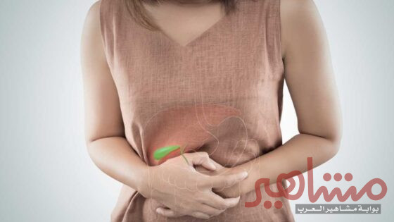 حصوة المرارة ونقاط مهمة يجب أن تعرفها