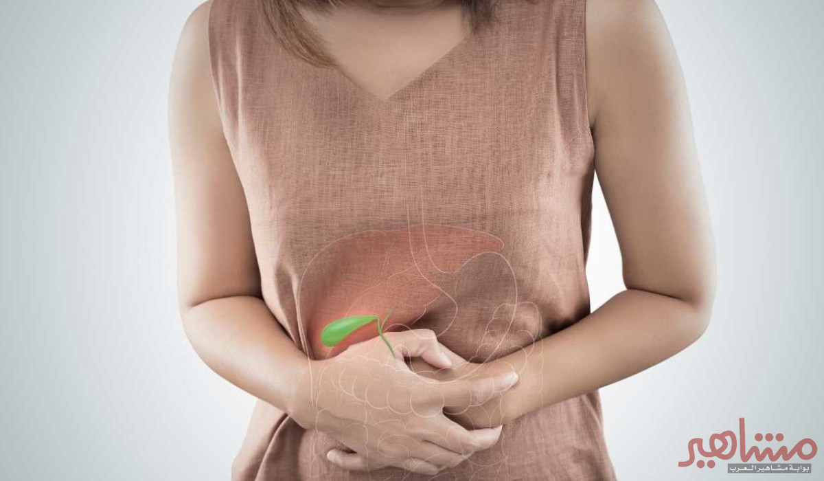 حصوة المرارة ونقاط مهمة يجب أن تعرفها