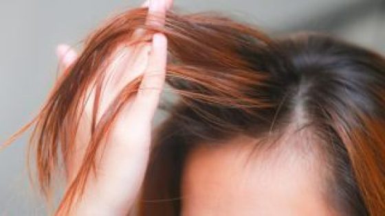 افضل الطرق للعناية بالشعر الجاف والمتقصف