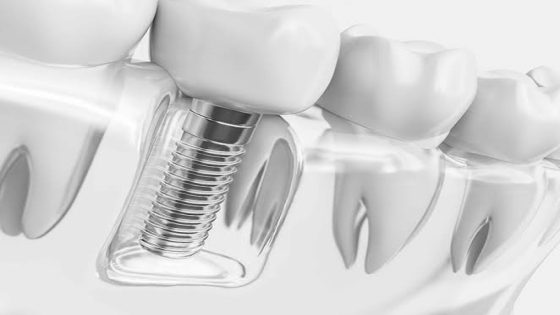 مركز دكتور عمار لطب الاسنان | أهمية تنظيف اسنان الاطفال من الجير وكيف تؤثر تكلفة تبييض الأسنان بالليزر 2026 على قرار العلاج